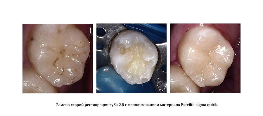 Без имени-1